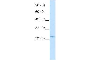 WB Suggested Anti-RGS13 Antibody Titration:  0. (RGS13 Antikörper  (Middle Region))