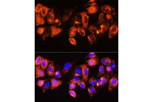 Immunofluorescence analysis of HeLa cells using IGFBP5 antibody (ABIN6130485, ABIN6142257, ABIN6142259 and ABIN6216084) at dilution of 1:100. (IGFBP5 Antikörper  (AA 68-167))