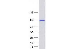Western Blotting (WB) image for Interferon Regulatory Factor 5 (IRF5) (Transcript Variant 5) protein (Myc-DYKDDDDK Tag) (ABIN2723800)