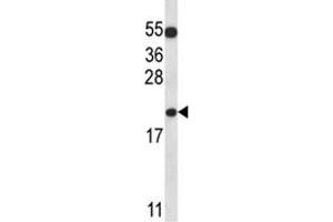 BAX antibody western blot analysis in K562 lysate