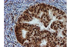 Image no. 1 for anti-Fragile X Mental Retardation 1 (FMR1) antibody (ABIN1498287) (FMR1 Antikörper)