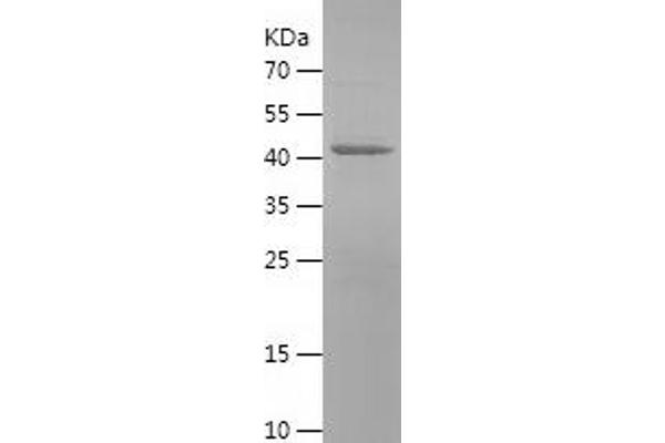 Monoamine Oxidase A Protein (MAOA) (AA 129-319) (His-IF2DI Tag)