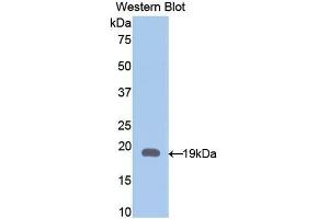 Detection of Recombinant GFAP, Rat using Polyclonal Antibody to Glial Fibrillary Acidic Protein (GFAP) (GFAP Antikörper  (AA 1-430))