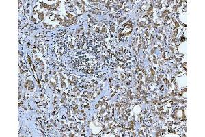 IHC analysis of PTRF/CAVIN1 using anti-PTRF/CAVIN1 antibody (ABIN7601817).