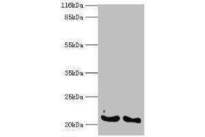 Western blot analysis of (1) A549 whole cell lysates and (2) mouse lung tissue, using IFNA14 antibody (2 μg/ml) and goat anti-rabbit polyclonal secondary antibody (1/10000 dilution). (IFNa14 Antikörper  (AA 24-189))