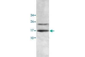 Western blot analysis of human fetal liver lysate with HINT2 polyclonal antibody  at 1 : 500 dilution. (HINT2 Antikörper  (AA 59-163))