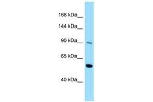Image no. 1 for anti-Colony Stimulating Factor 2 Receptor, Beta (CSF2RB) (AA 578-627) antibody (ABIN6748119) (CD131 Antikörper  (AA 578-627))