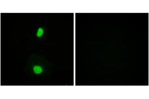 Immunofluorescence analysis of HeLa cells, using TIP60 (Ab-86) Antibody. (KAT5 Antikörper  (AA 52-101))