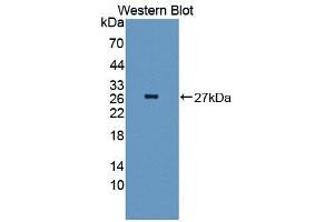 Western blot analysis of the recombinant protein. (TNFRSF1A Antikörper  (AA 239-433))