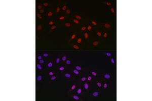 Immunofluorescence analysis of U2OS cells using CTBP2 Rabbit mAb (ABIN7265979) at dilution of 1:100 (40x lens). (CTBP2 Antikörper)