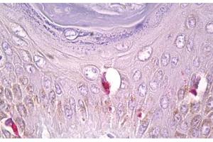 Anti-PLCG1 antibody IHC staining of human skin, Langerhans cell. (Phospholipase C gamma 1 Antikörper  (AA 751-800))