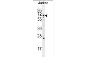 GCLC Antibody (N-term) (ABIN655884 and ABIN2845285) western blot analysis in Jurkat cell line lysates (35 μg/lane). (GCLC Antikörper  (N-Term))