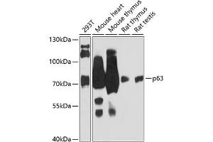 Western blot analysis of extracts of various cell lines, using p63 antibody (ABIN6133473, ABIN6149426, ABIN6149429 and ABIN6216798) at 1:3000 dilution. (p63 Antikörper  (AA 1-160))