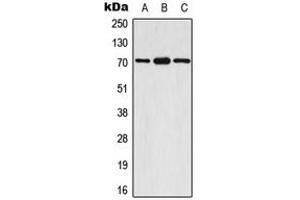 Western blot analysis of S6K1 (pS447) expression in A549 EGF-treated (A), mouse brain (B), rat brain (C) whole cell lysates. (RPS6KB1 Antikörper  (C-Term, pSer447))