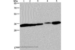 Western blot analysis of HUVEC and 293T cell, mouse bladder, human placenta and mouse kidney tissue, using CLDN23 Polyclonal Antibody at dilution of 1:200 (Claudin 23 Antikörper)