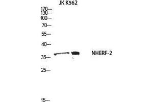 Western Blot (WB) analysis of JK K562 using NHERF-2 antibody. (SLC9A3R2 Antikörper)