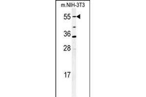 Western blot analysis of CYP26A1 Antibody (C-term) (ABIN650717 and ABIN2837925) in mouse NIH-3T3 cell lysates (35 μg/lane). (CYP26A1 Antikörper  (C-Term))
