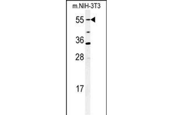 CYP26A1 Antikörper  (C-Term)