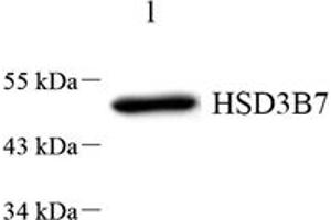 Western blot analysis of HSD3B7 (ABIN7074263) at dilution of 1: 1000,Lane 1: HeLa cell lysate