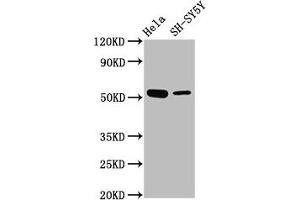 Western Blot Positive WB detected in: Hela whole cell lysate, SH-SY5Y whole cell lysate All lanes: MEX3A antibody at 4. (MEX3A Antikörper  (AA 416-466))