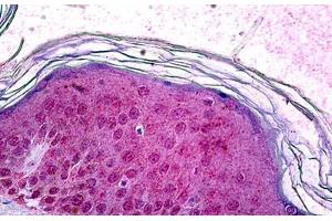 Human Skin: Formalin-Fixed, Paraffin-Embedded (FFPE) (SOX10 Antikörper)