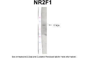 WB Suggested Anti-N32F1 Antibody Titration: 2 ug/mlPositive Control: Protein extracts, Chicken brain tissue