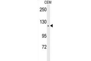 Western Blotting (WB) image for anti-threonine Synthase-Like 2 (THNSL2) antibody (ABIN3002296) (THNSL2 Antikörper)