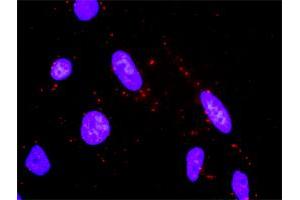 Proximity Ligation Analysis of protein-protein interactions between MAP2K3 and MAP2K6. (MAP2K6 Antikörper  (AA 231-334))