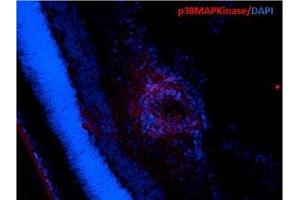 Immunohistochemistry analysis using Mouse Anti-p38 MAPK Monoclonal Antibody, Clone 9F12 (ABIN361679 and ABIN361680). (MAPK14 Antikörper)