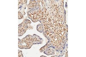 Immunohistochemistry (Paraffin-embedded Sections) (IHC (p)) image for anti-CD276 (CD276) (AA 493-522), (C-Term) antibody (ABIN656709)