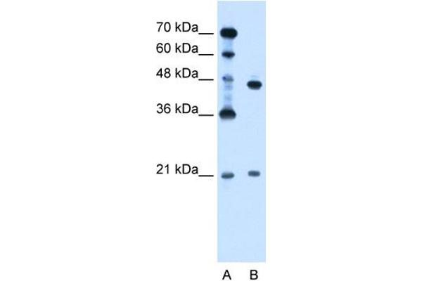 UBE2E2 Antikörper  (N-Term)