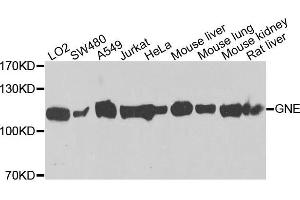Western blot analysis of extracts of various cells, using GNE antibody.