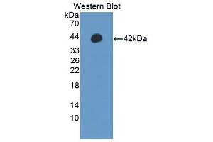 Western blot analysis of the recombinant protein. (IRF5 Antikörper  (AA 136-475))