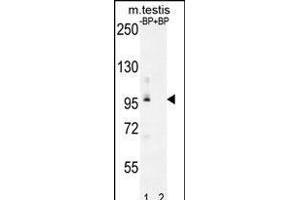 Western blot analysis of PDPR Antibody (C-term) Pab (ABIN655953 and ABIN2845339) pre-incubated without(lane 1) and with(lane 2) blocking peptide in mouse testis tissue lysate. (PDPR Antikörper  (C-Term))