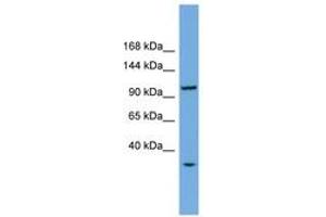 Image no. 1 for anti-CTF18, Chromosome Transmission Fidelity Factor 18 Homolog (CHTF18) (AA 755-804) antibody (ABIN6745169) (CTF18 Antikörper  (AA 755-804))