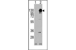 Image no. 1 for anti-Platelet Derived Growth Factor Receptor alpha (PDGFRA) (Tyr754) antibody (ABIN359914) (PDGFRA Antikörper  (Tyr754))