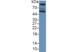 Western Blotting (WB) image for anti-Hexosaminidase A (HEXA) (AA 318-529) antibody (ABIN7431284)