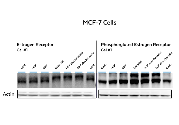 Western blot elektrophoretischer Mobilitätsverschiebungstest (EMSA): Estradiol-stimulierte Phosphorylierung von Östrogenrezeptoren auf MCF-7 Brustkrebszellen