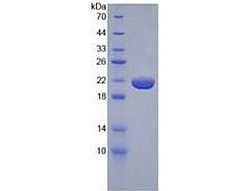 SDS-PAGE of Protein Standard