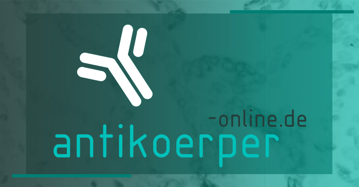 (c) Antikoerper-online.de